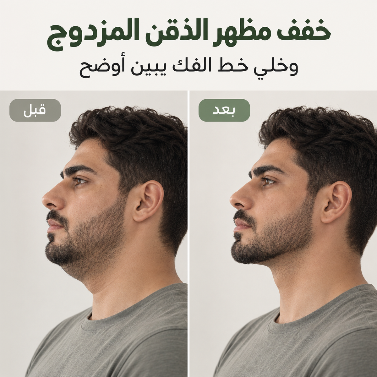 مشد الذقن المزدوج لتحديد الفك وتخفيف اللغلوغ (للرجال)